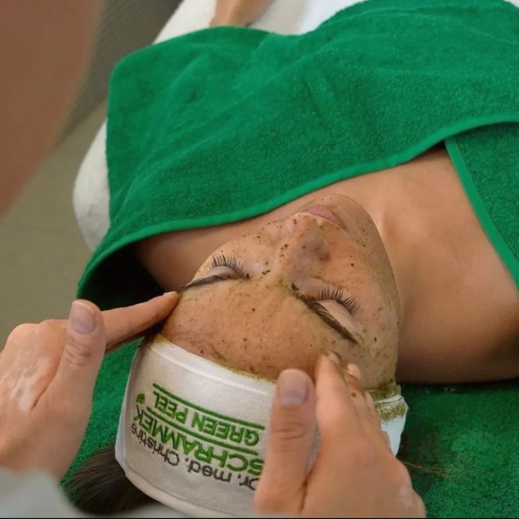 Green Peel